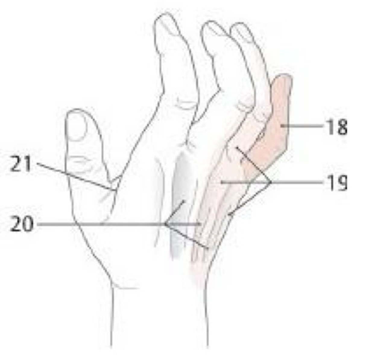 <p>What is the clinical significance of this picture? What nerve is associated with this?</p>