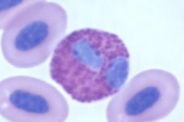 What kind of leukocyte is this?