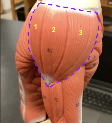 <p>Which muscle is this ? </p>