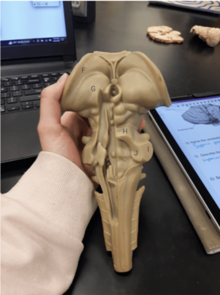 <p>Label this image of the dorsal brainstem model : caudate nucleus, thalamus, 3 cerebellar peduncles</p>