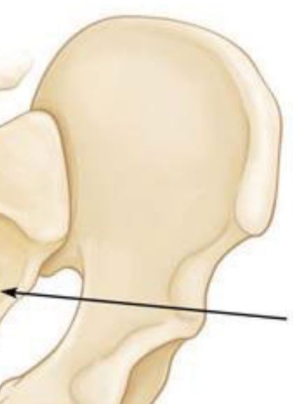 <p>Large, broad pair of bones forming each half of the pelvis.</p>