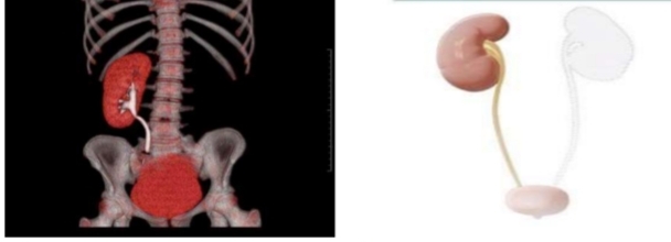 <p>identify then define </p>