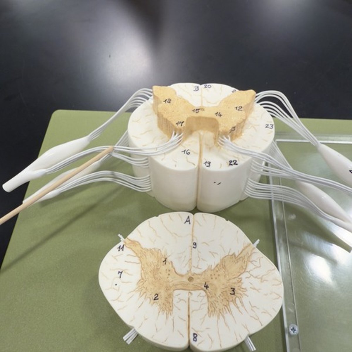 <p>Identify the structure.</p>