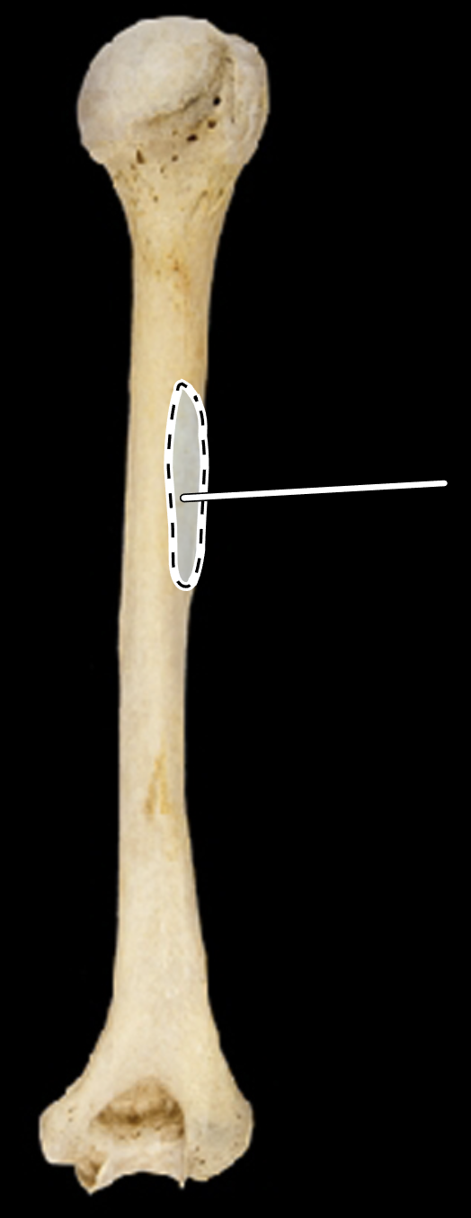 <p>Name the highlighted portion.</p><p>(Posterior view).</p>