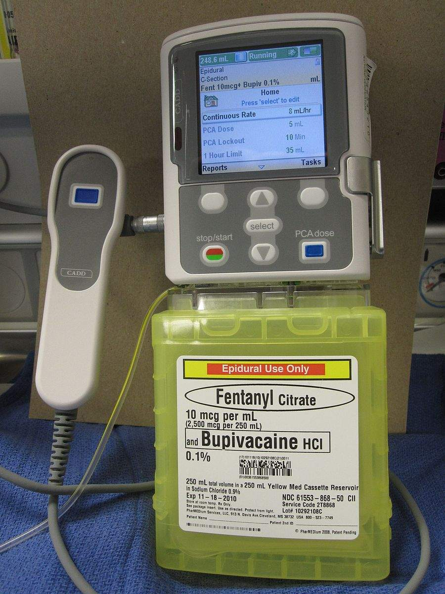 <p>What are <strong>PCA (Patient-Controlled Analgesia) pumps? What do they do?</strong></p>