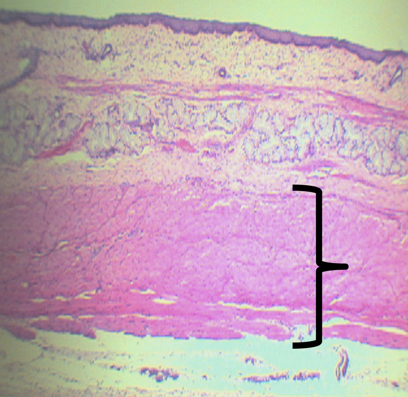 <p>Auerbach’s/ Myenteric plexus</p>