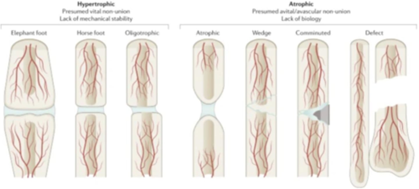 <p>Hypertrophic: presumed vital non-union, lack of mechanical stability</p><p>Atrophic: presumed avital/avascular non-union, lack of biology</p>