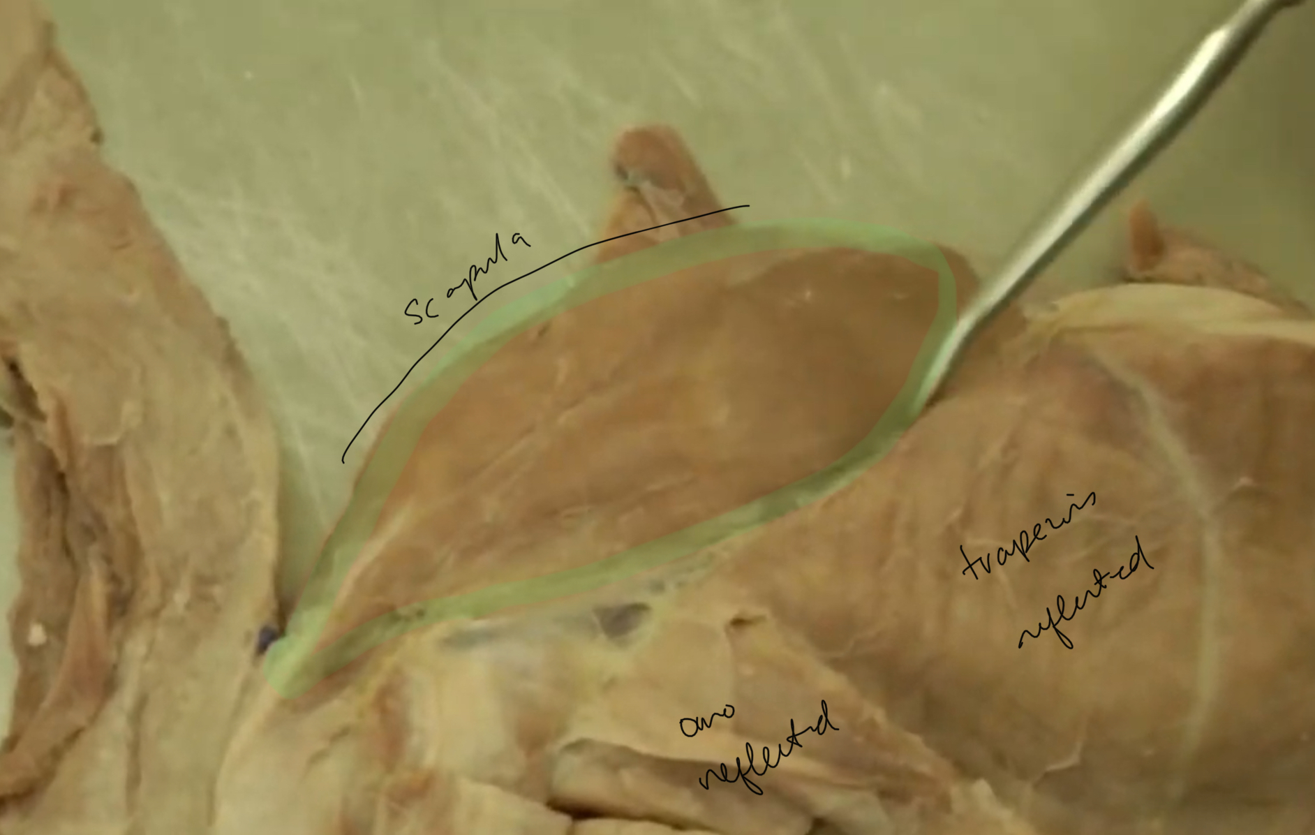 <p>what is highlighted</p>