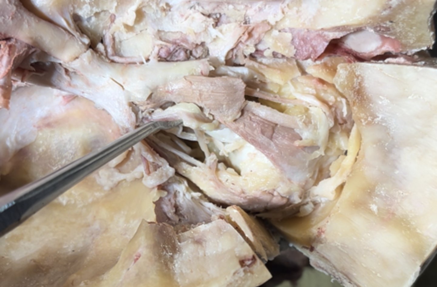 <p>The artery running ontop of the optic nerve is the</p>