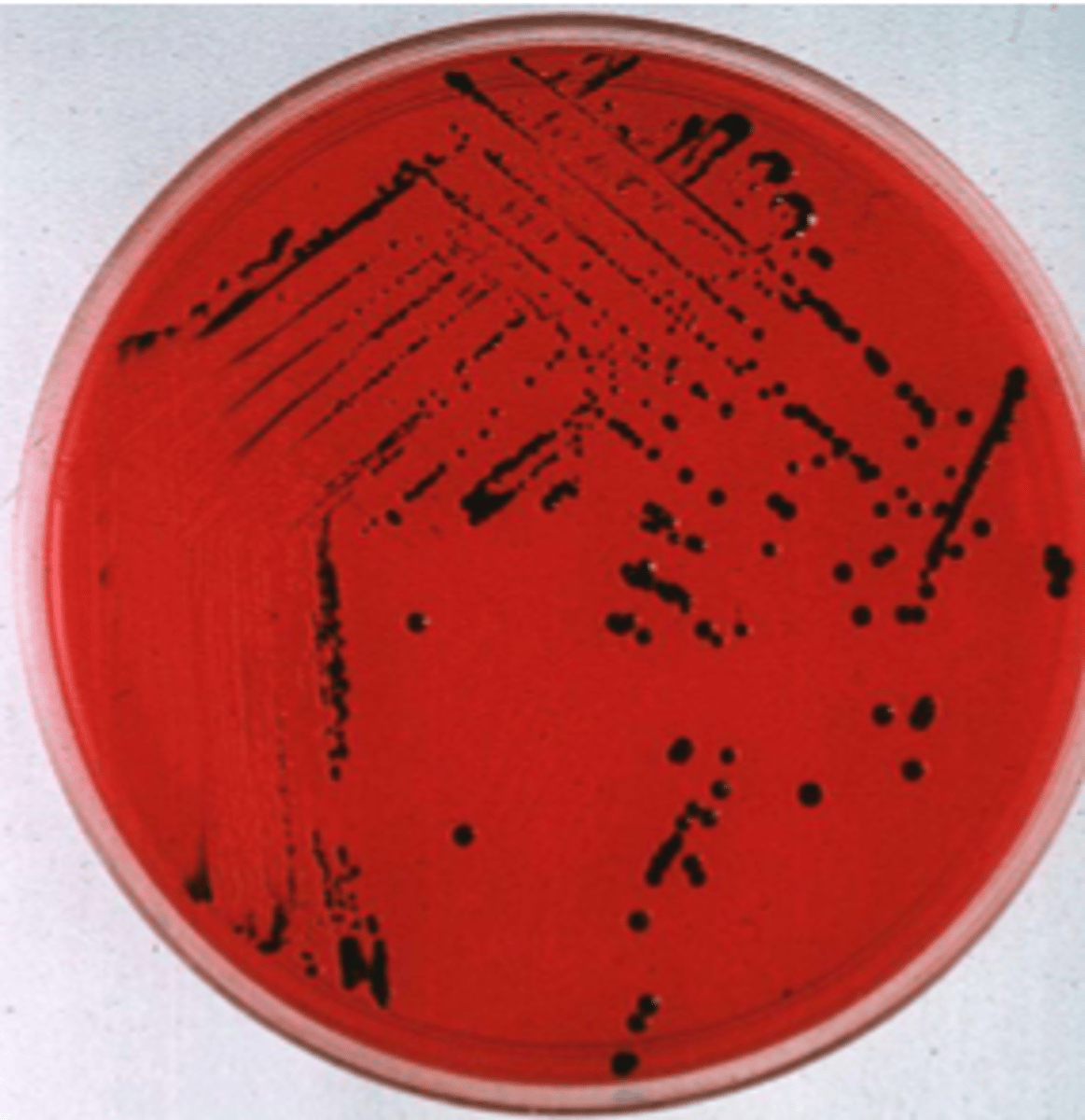 <p>clear, NLF (MAC) and black center (HE and XLD)</p>