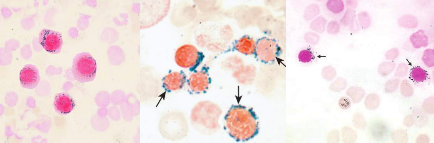 <p>A. Identify the cell<br>B. Identify the disease / condition</p>