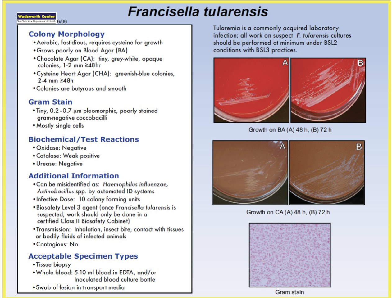 <p>Summary of Francisella tularensis</p>