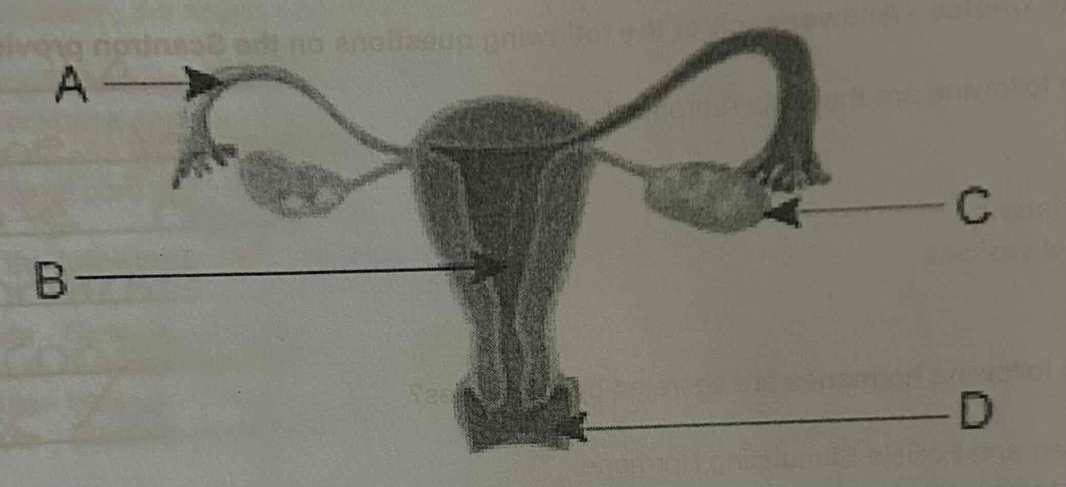 <p><span>In which of the following structures is the myometrium located?</span><br><span>A.</span><br><span>B.</span><br><span>C.</span><br><span>D. </span></p>