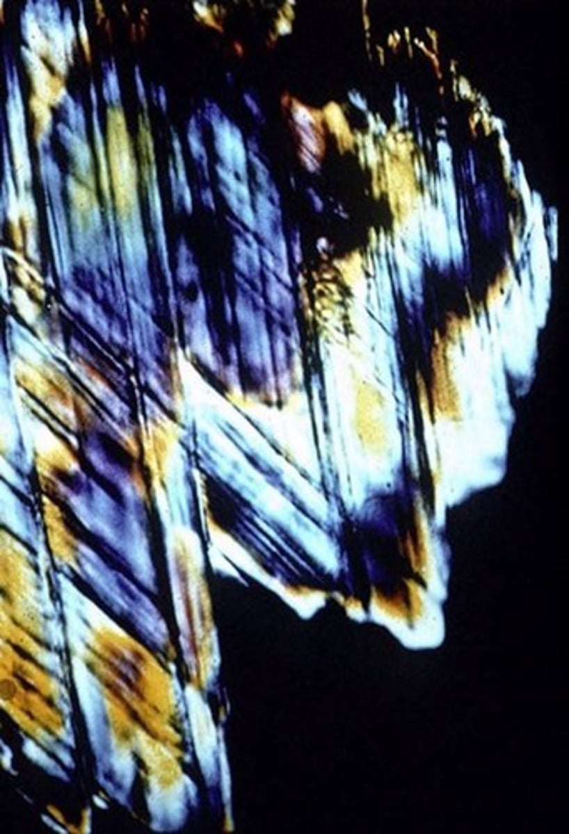 <p>>= 2 sets parallel deformation features, only at craters and nuclear sites</p>