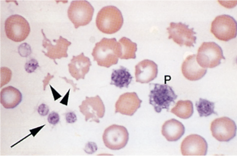 The basophilic staining structure below the letter "P" is a