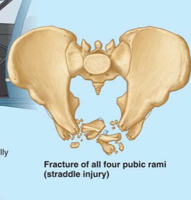 <p>What kind of injury is this </p>
