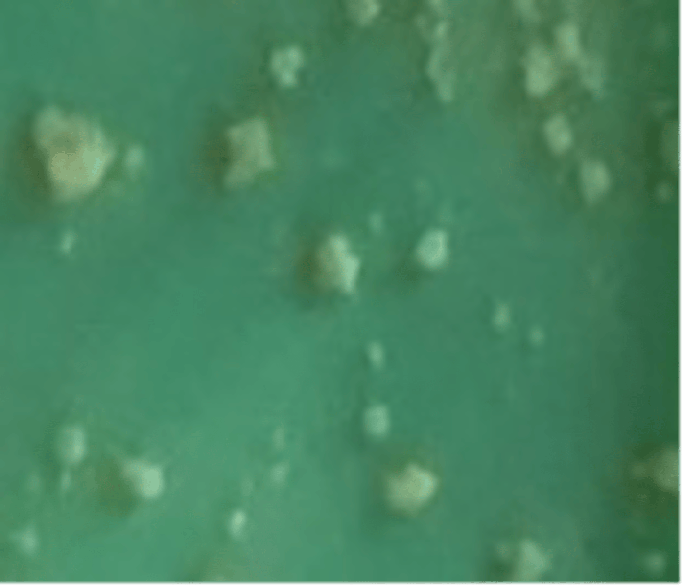 <p>what Mycobacterium spp. is indicated in this image that affects cattle</p>