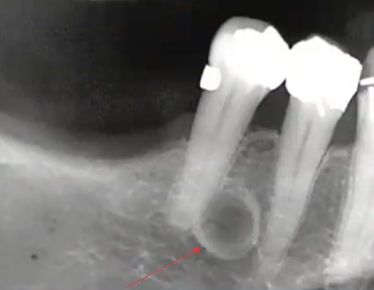 <p>how would you describe the border of this lesion</p>