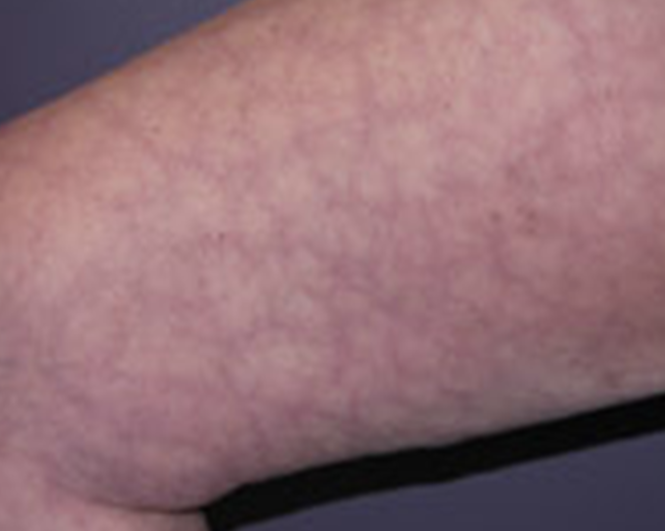 <p>what condition is this? </p><p></p><p></p>