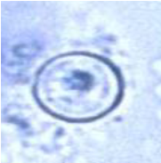 <ul><li><p><span>8-10 microns</span></p></li><li><p><span>Emerging pathogen</span></p></li><li><p><span>Flu-like illness with nausea, vomiting, weight loss, explosive diarrhea</span></p></li><li><p><span>Lasts 1-3 weeks</span></p></li><li><p><span>No animal reservoir</span></p></li><li><p><span>Human feces contaminated food and water</span></p></li><li><p><span>2-days to 2-weeks incubation period</span></p></li></ul><p></p>