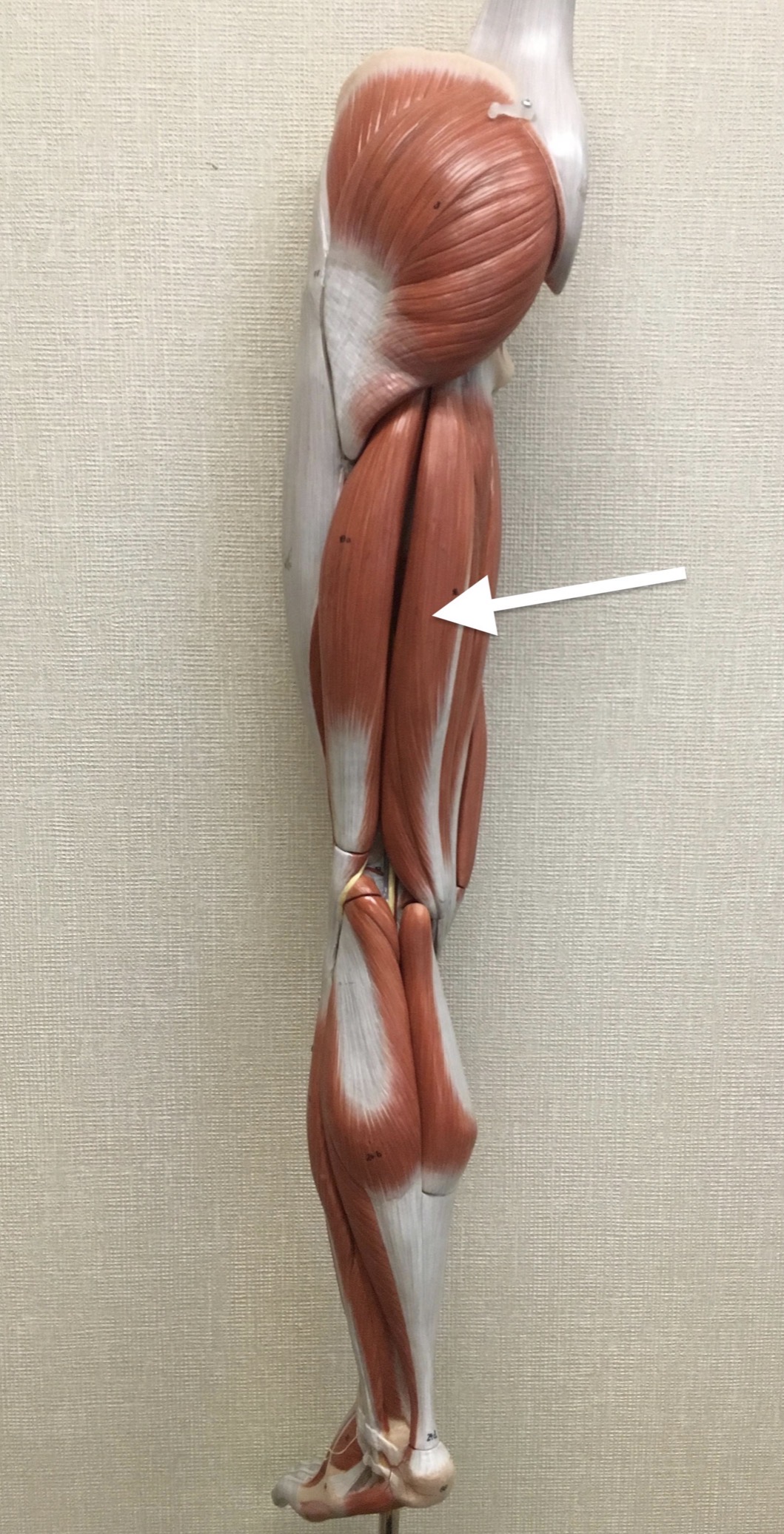 <p><span>Name the muscle labeled with the white arrow below AND name the insertion .</span></p>