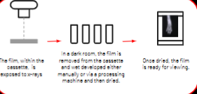 <p>The image is produced by exposing film contained within a cassette that must then be developed using wet-processing</p>