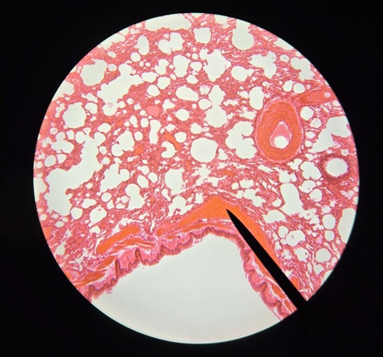 <p>What is this tissue? (It forms in spirals, not rings)</p>