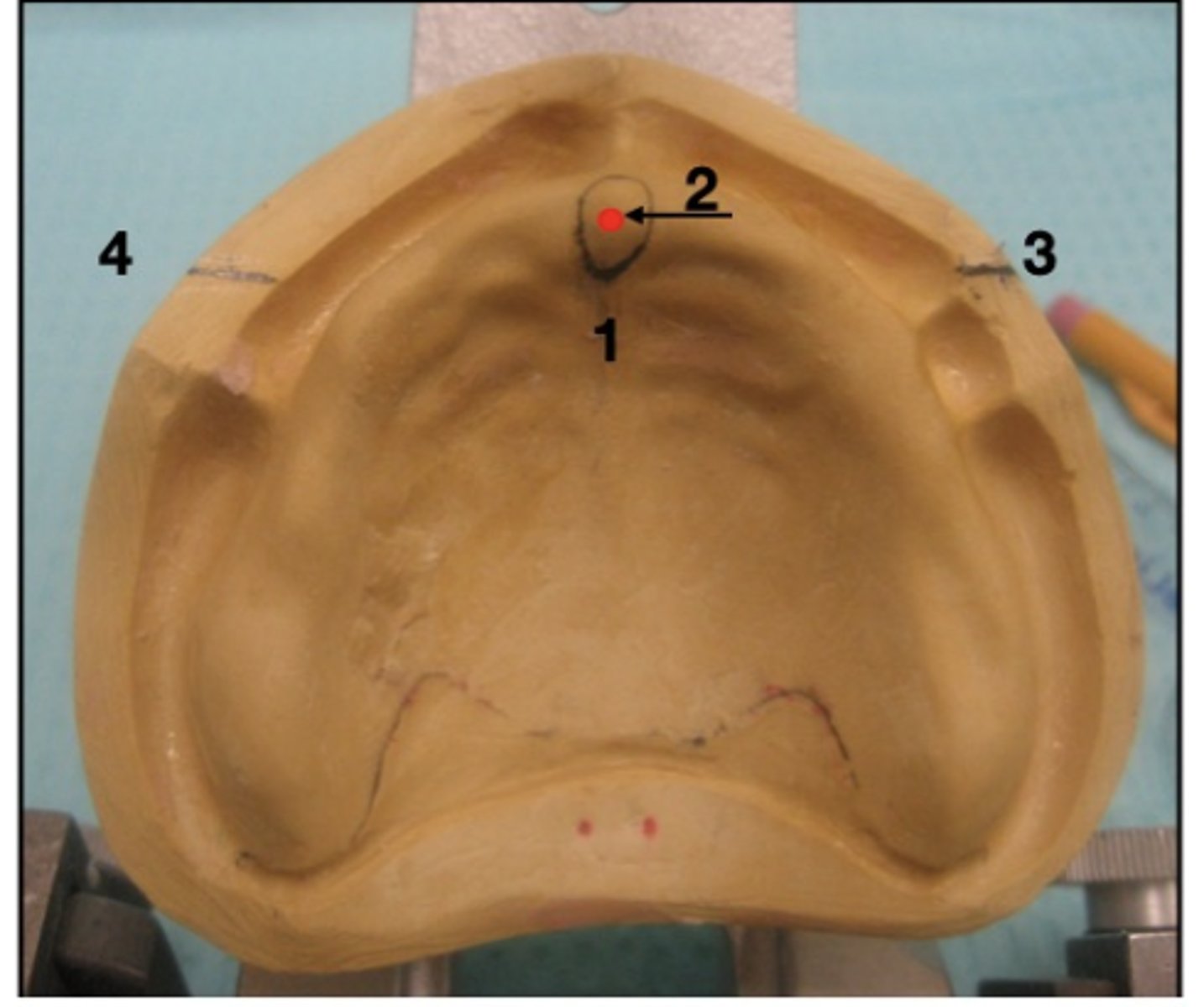 <p>What are 3 and 4?</p>