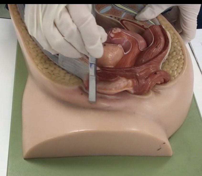 <p>Description: Larger, hair covered folds created by subcutaneous fat</p><p>Relationship: Protects external genitalia</p>