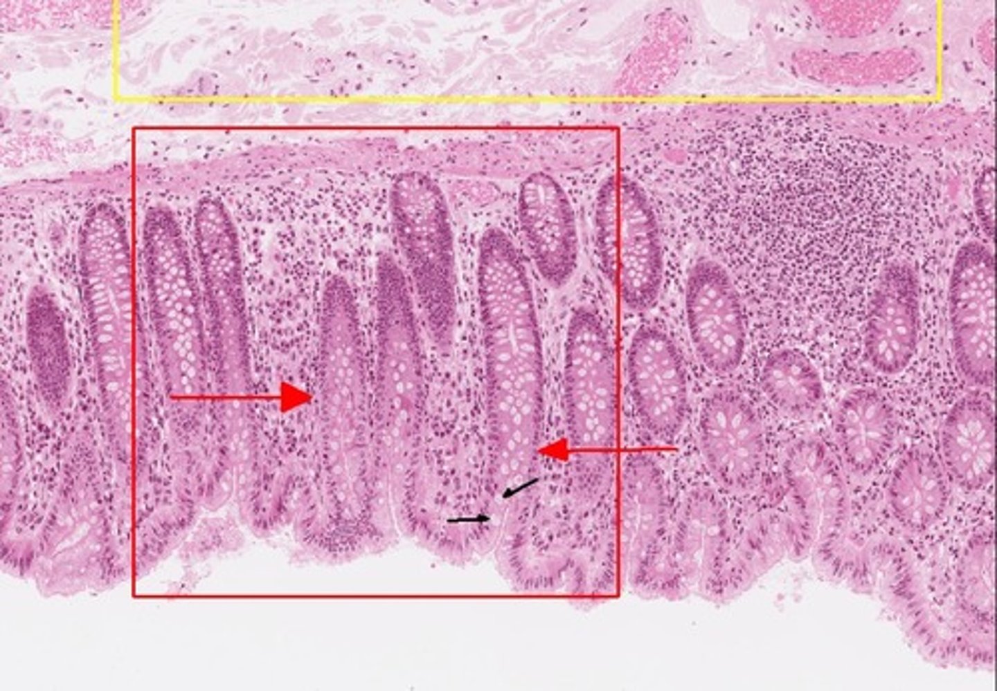 knowt flashcard image
