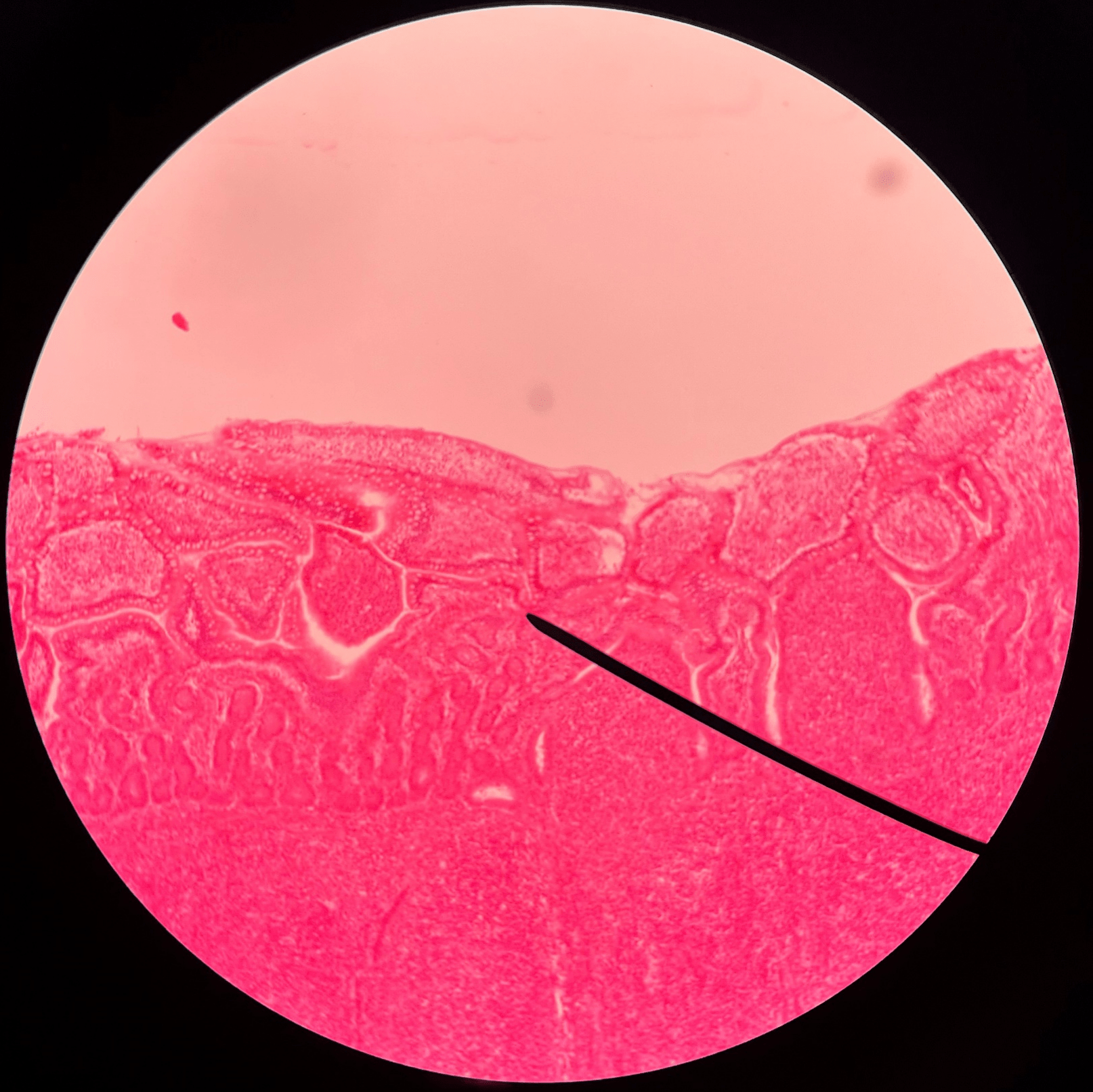 • Slide histology of the ileum.

• Located in the mucosa layer of the ileum.

• Increases the absorptive surface of the lining epithelium.