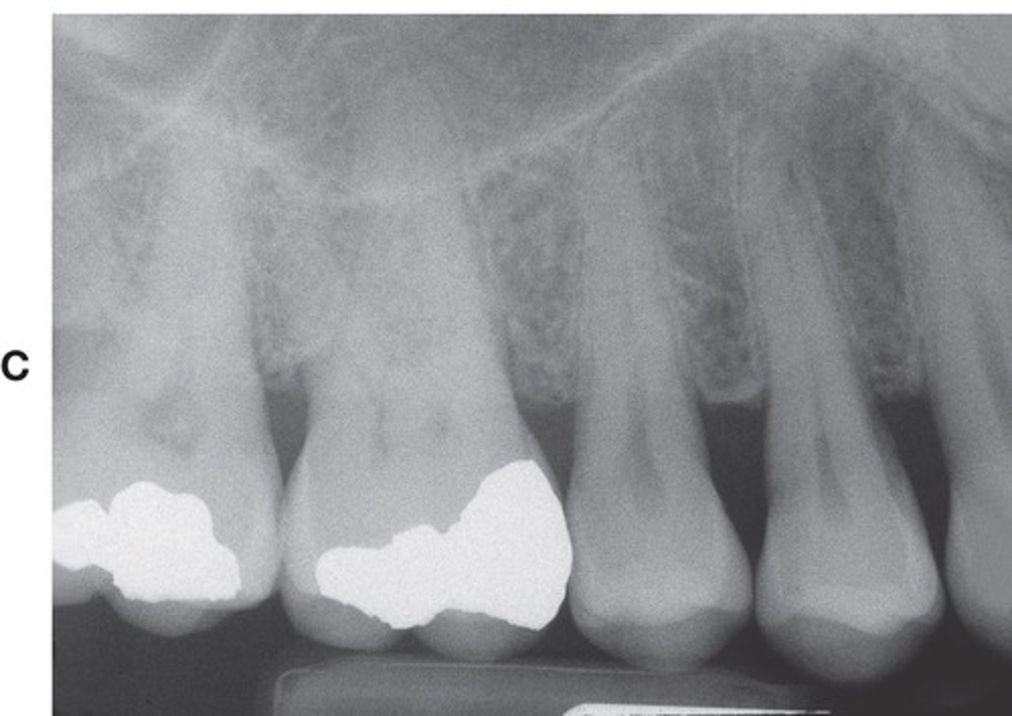 <p>- two to four teeth.</p>