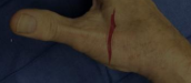 <p>what kind of wound is this</p>