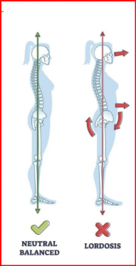 <p>Câu 23: Tật ưỡn lưng tiếng Anh là gì?<span><span>&nbsp;</span></span></p><p class="MsoNormal">A. Lordosis<span style="font-family: "Segoe UI Symbol", sans-serif;"><span>✓</span></span><span><span>&nbsp;</span></span></p><p class="MsoNormal">B. Kyphosis<span><span>&nbsp;</span></span></p><p class="MsoNormal">C. Scoliosis<span><span>&nbsp;</span></span></p><p class="MsoNormal">D. Torticollis<span><span>&nbsp;</span></span></p>