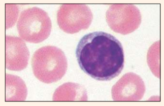 <p>Identify the blood cell</p>