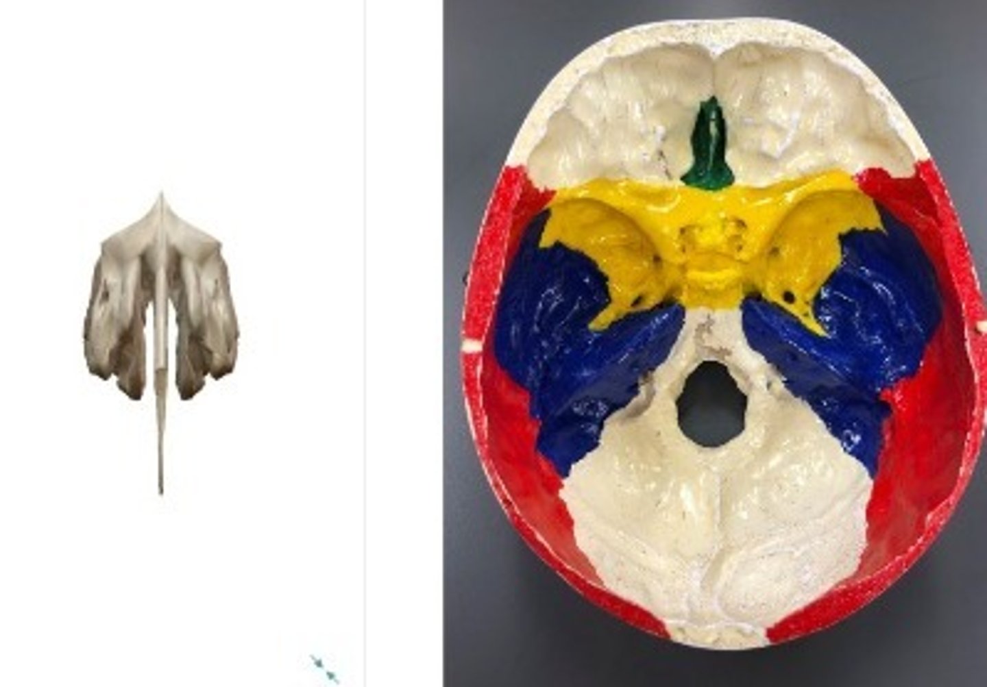 <p>What category of bone is it? What bone is it?</p>