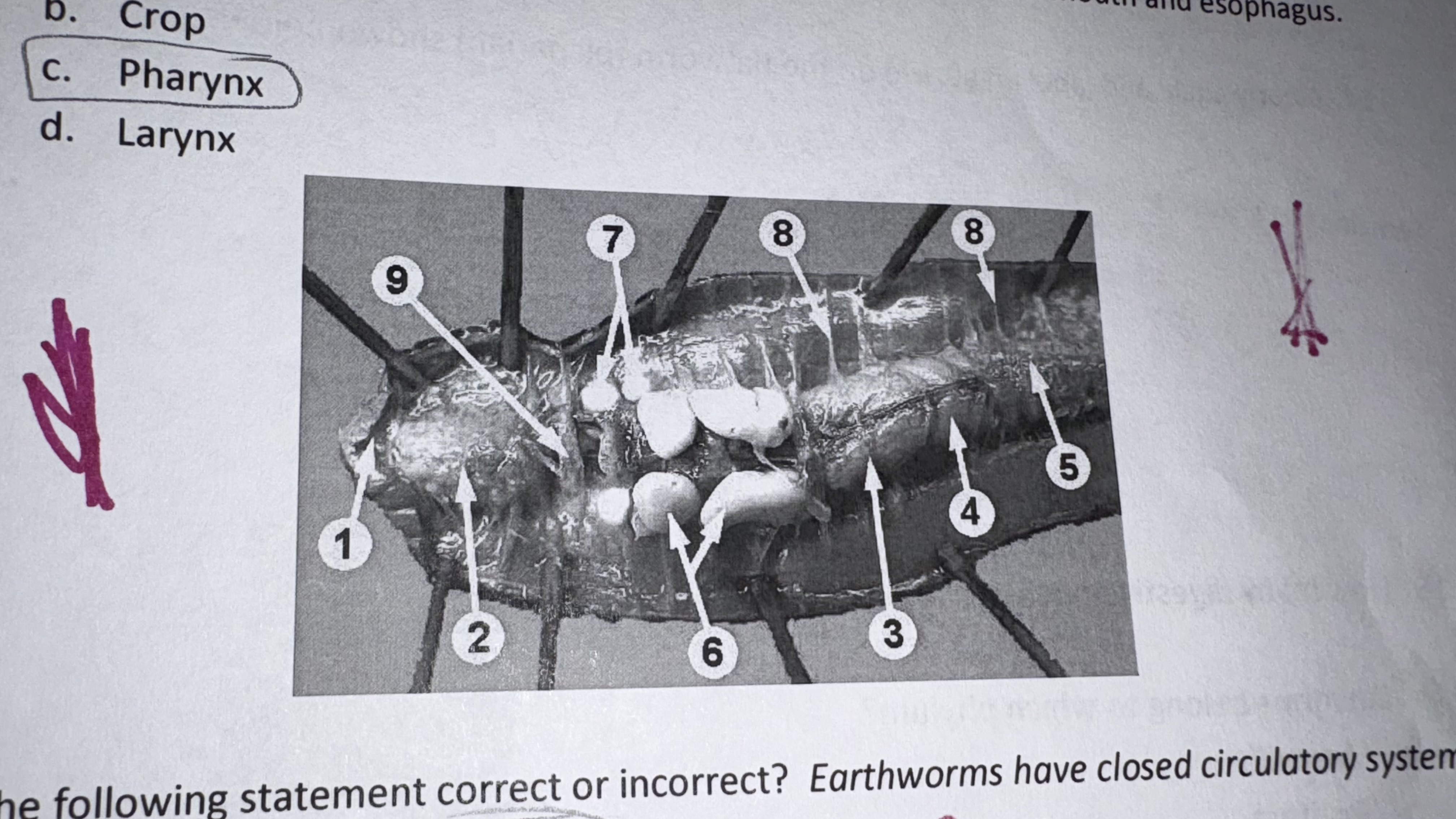 <p>label 5 on the earthworm </p>