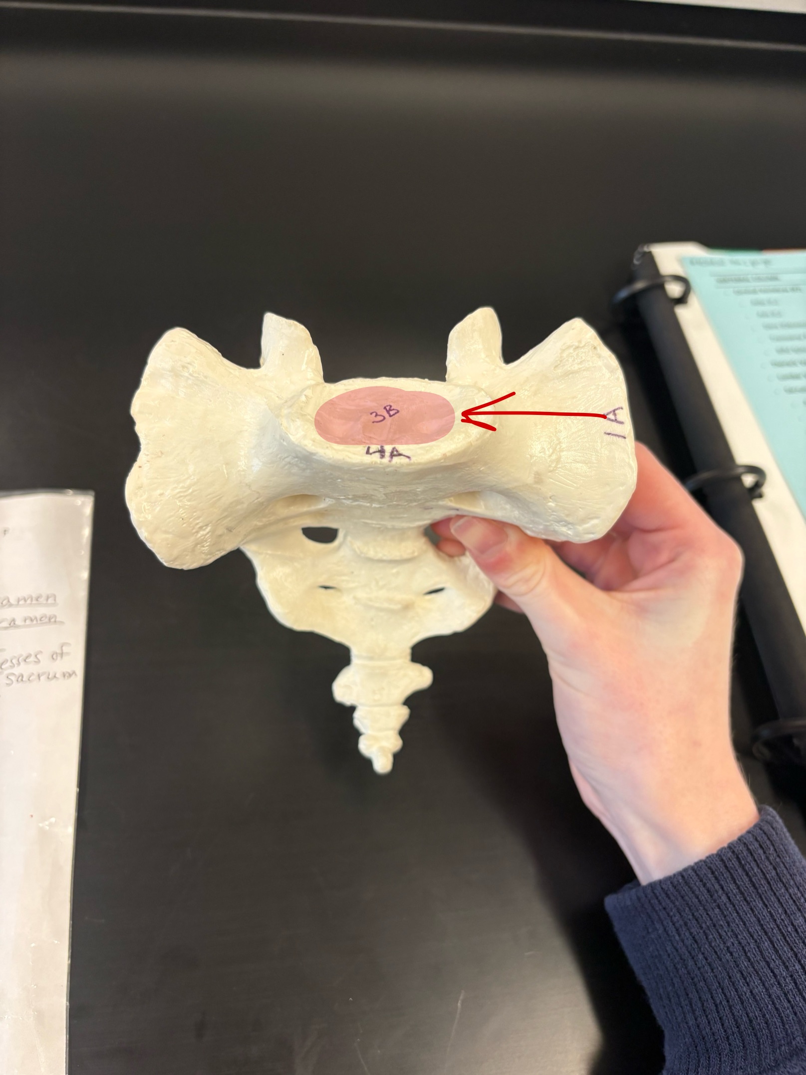 <p>Name this structure</p>