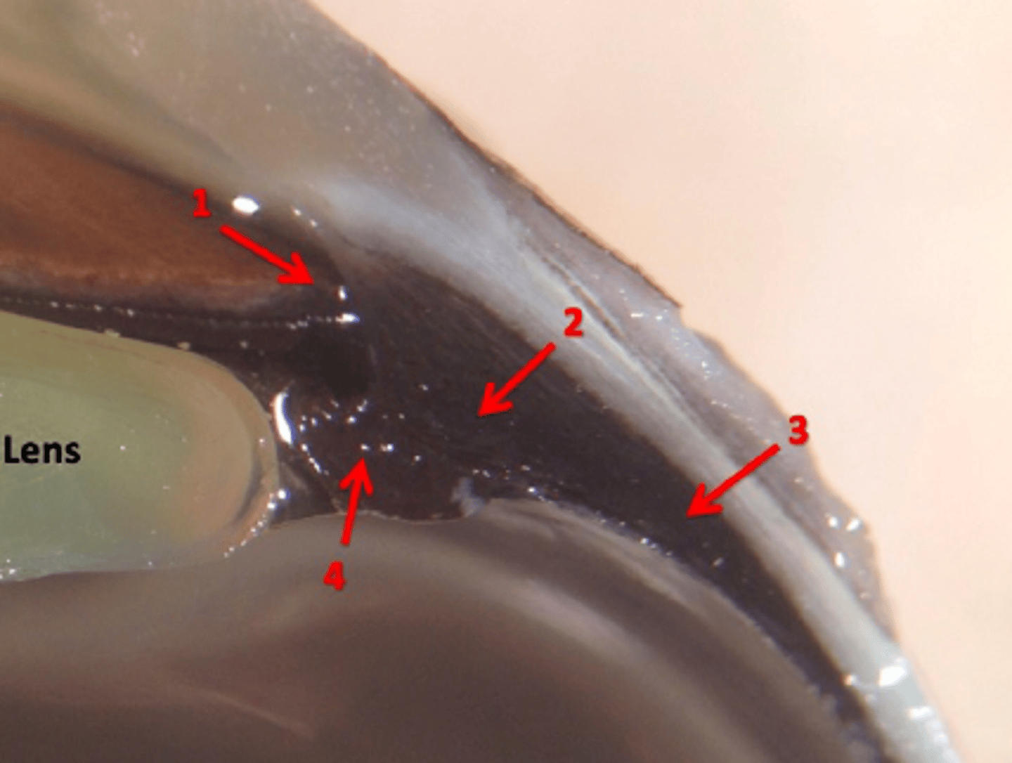 <p>#2</p>