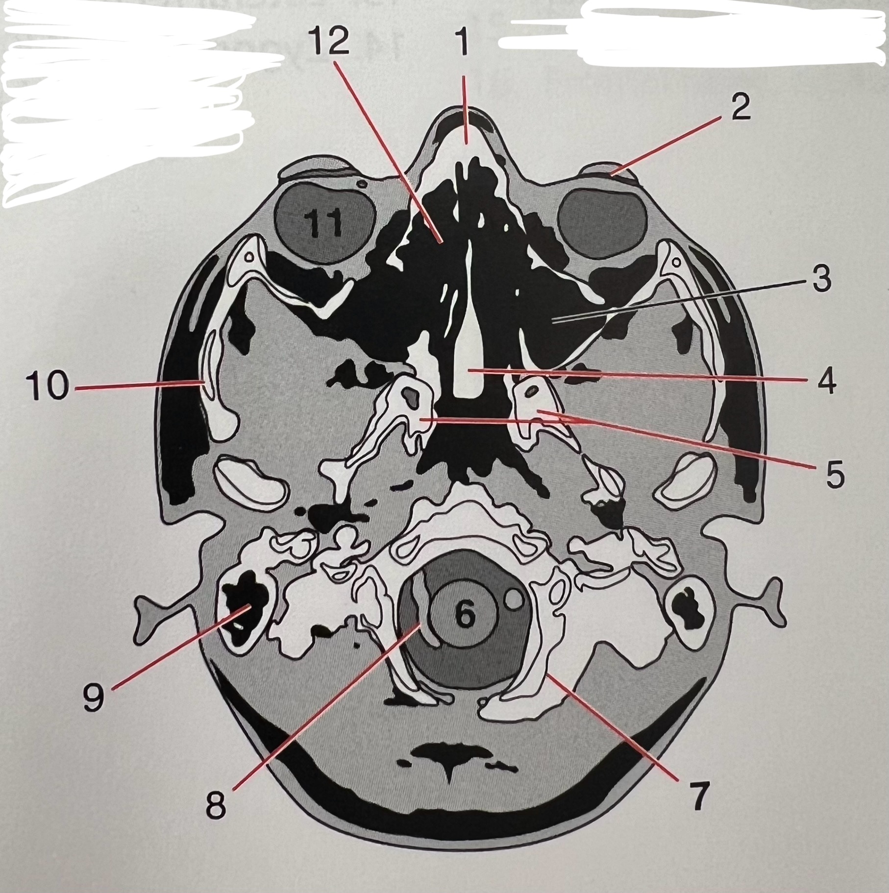 <p>11</p>