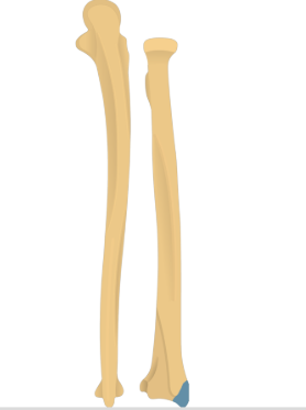 <p>name this bone or bone marking</p>