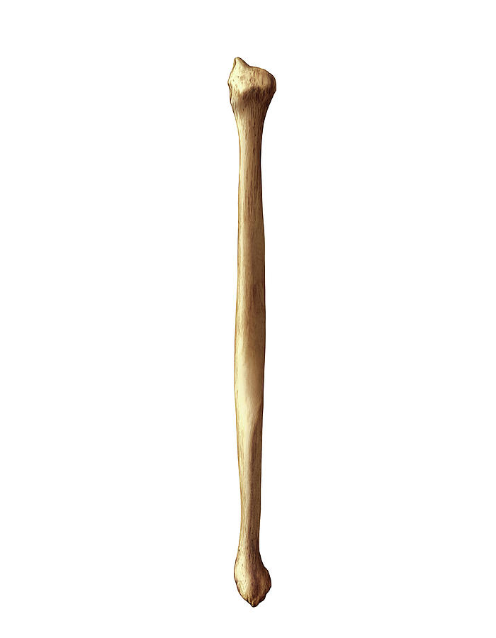 <p>Identify the bone.</p>
