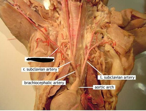 <p>carries oxygenated blood to upper limb and surrounding areas</p>