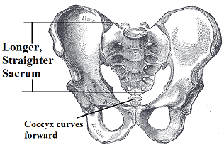 tall, narrow, heart-shaped, pubic arch <90 degrees
