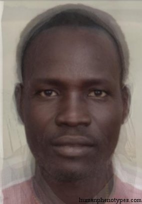 <p>Identify this Phenotype</p>