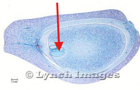 <p>What is being indicated on the Zamia Ovule?</p>