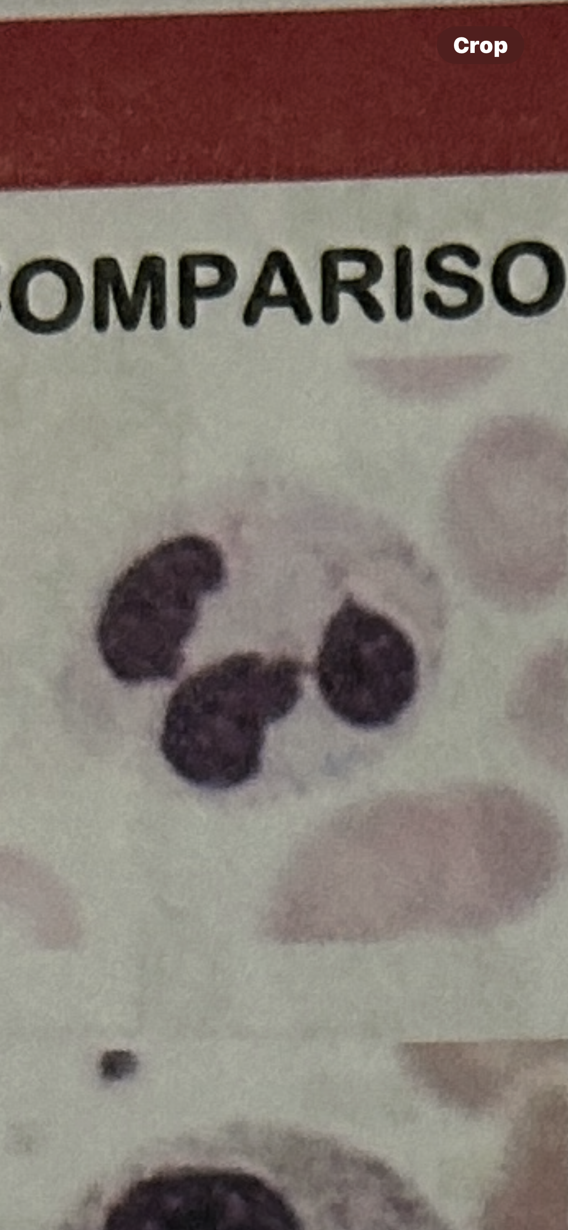 <p>What WBC</p>