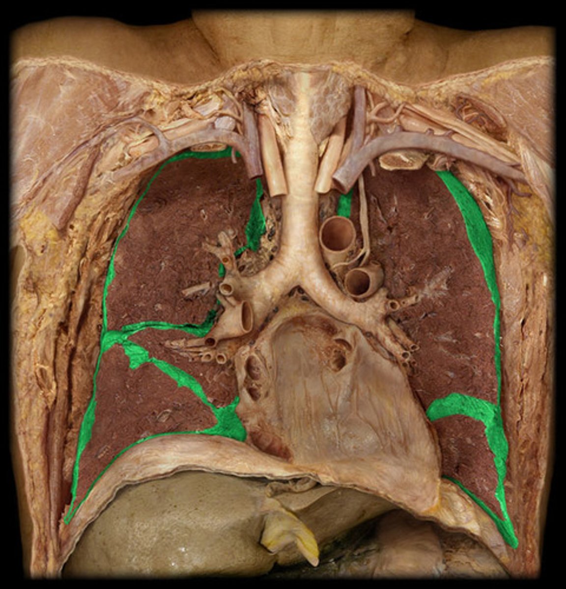 <p>the inner layer of pleura that surrounds each lung</p>