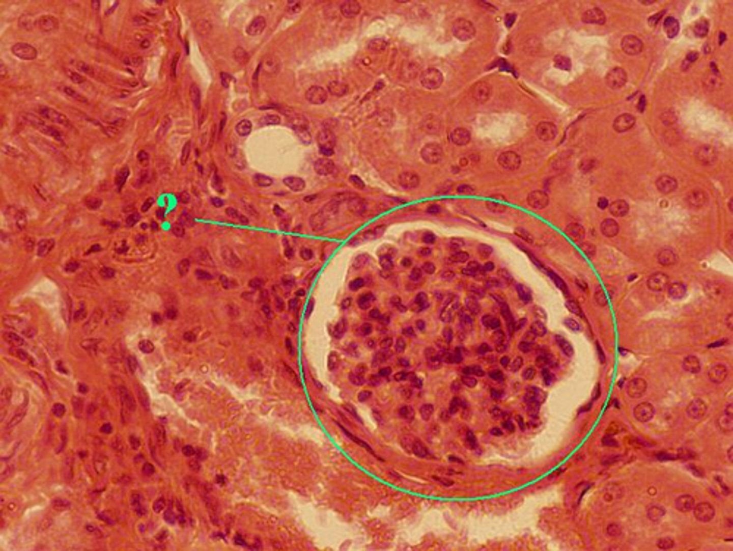 <p>glomerulus</p>