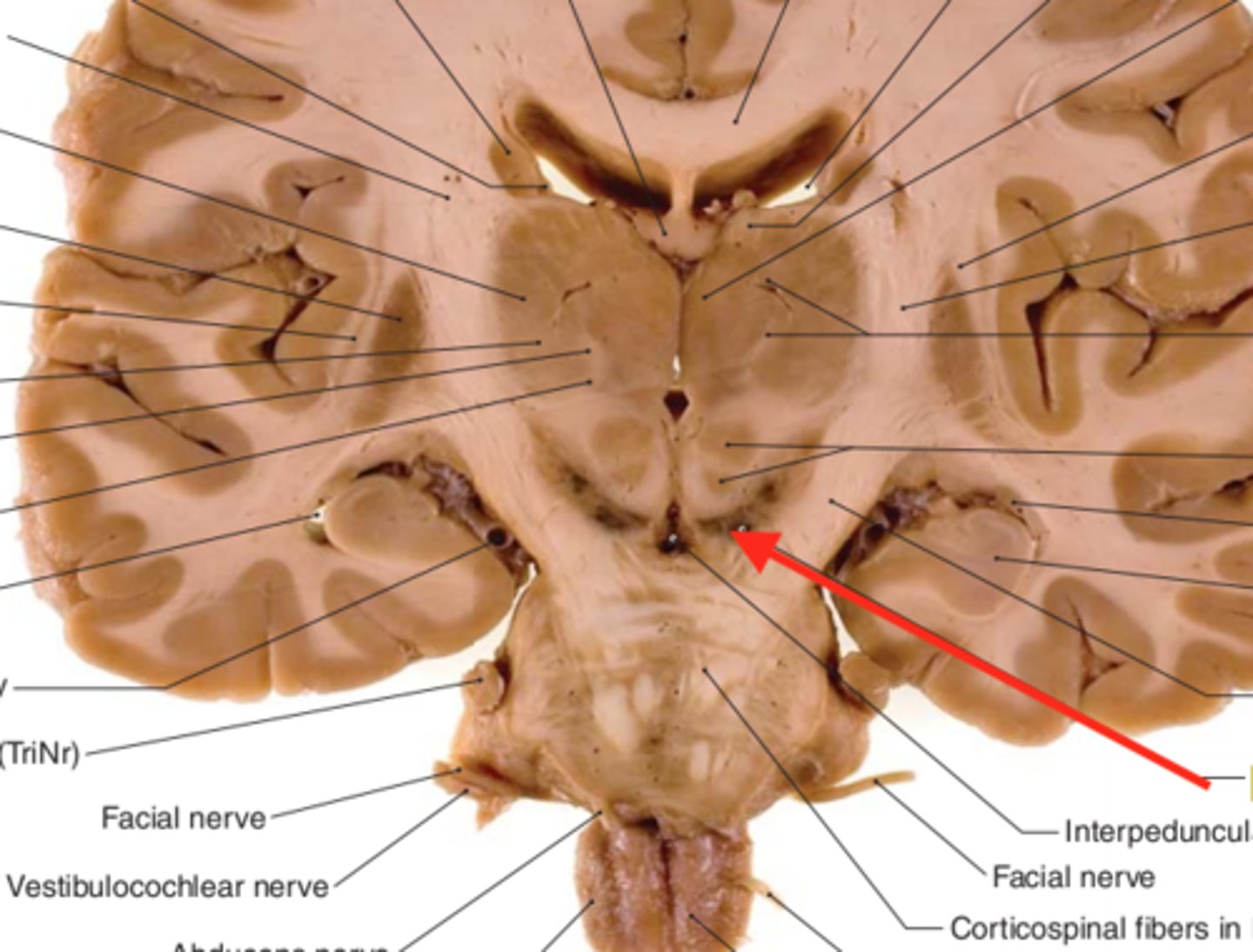 <p>a dark pigmented line in the midbrain</p>